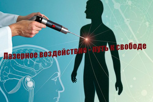 Лазерное лечение